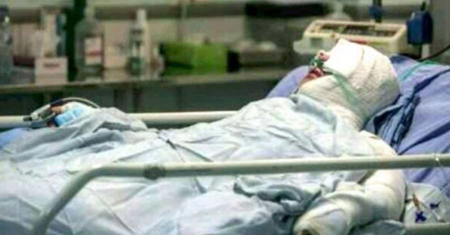 سالانه ۱۳۰۰ کارگر در ایران  به دلیل سوختگی ناشی از برق گرفتگی «دچار نقص عضو» می‌شوند