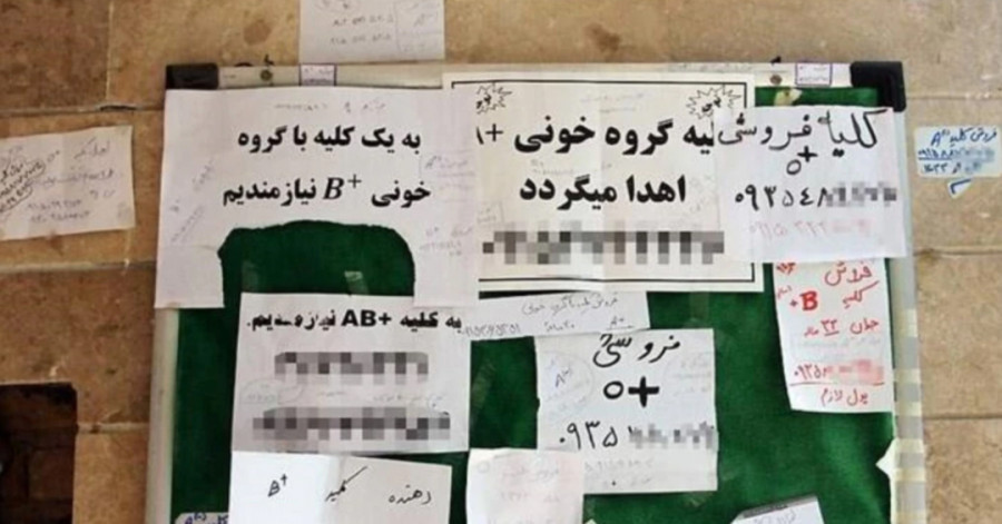 مقام مسئول: مشکلات اقتصادی قیمت فروش کلیه را تا ۲۰۰ میلیون تومان رسانده است
