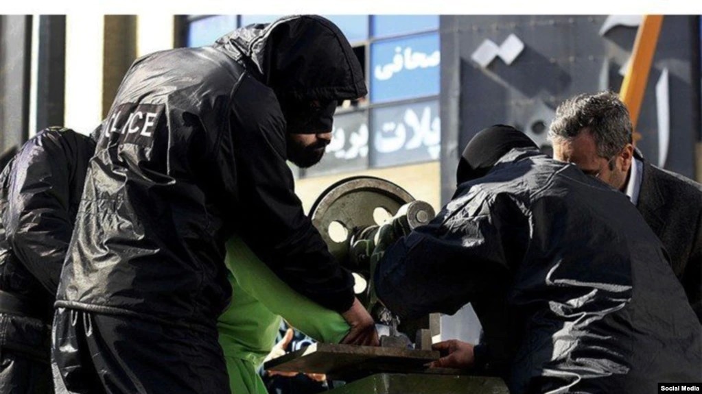 رئیس جامعه جراحان ایران به رئیسی: اجرای حکم قطع انگشت زندانیان «وهن اسلام» است