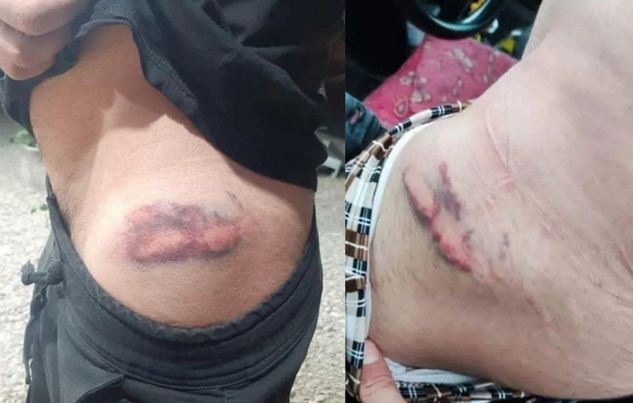 ضرب و جرح فعالین آذربایجانی در اعتراضات شهر ارومیه