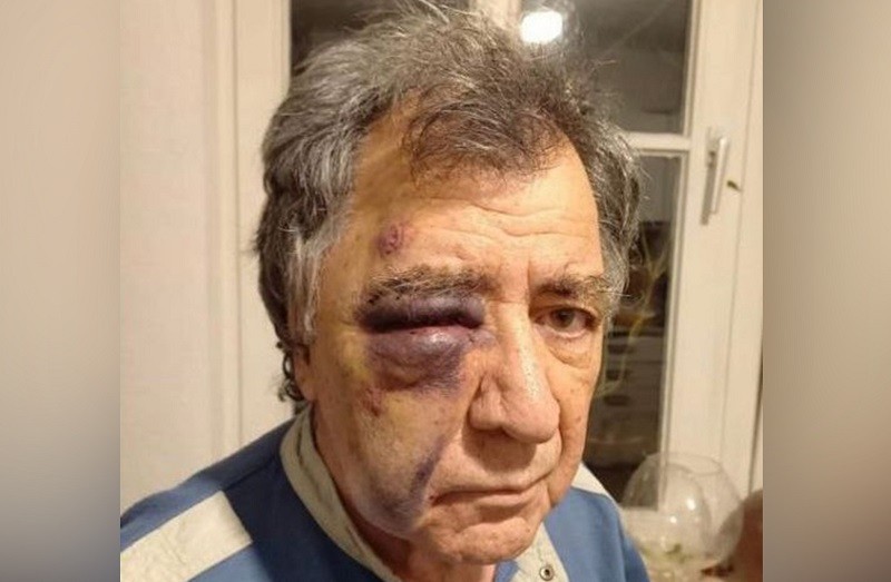 حمله افراد ناشناس به خانه دکتر «نورالدین قروی» فعال آذربایجانی ساکن آلمان