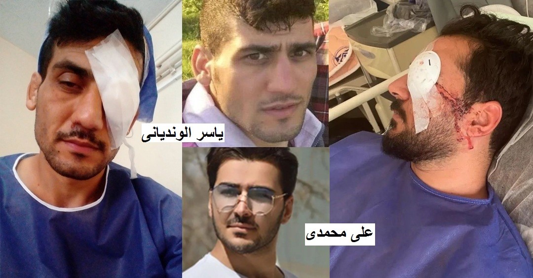 چشم‌هایی که هدف قرار گرفتند / چشم دو جوان در همدان نابینا شد