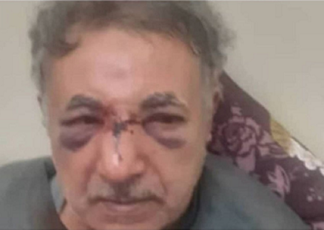 Təbriz sakini məmurlar tərəfindən vəhşicəsinə döyüldü-FOTO