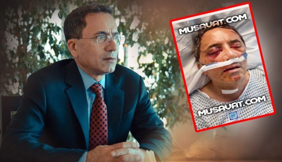 Əhməd Obalının mühafizəsi gücləndirildi- "Tibb müəssisəsi ciddi nəzarətə götürülüb"
