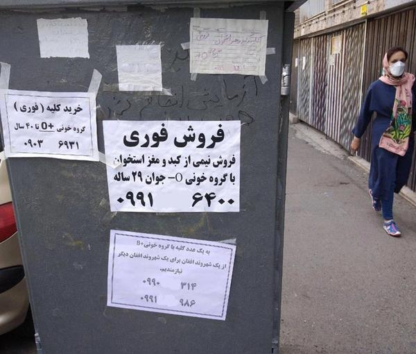 İranda yoxsulluq insanları bədən üzvlərini satmağa vadar edir