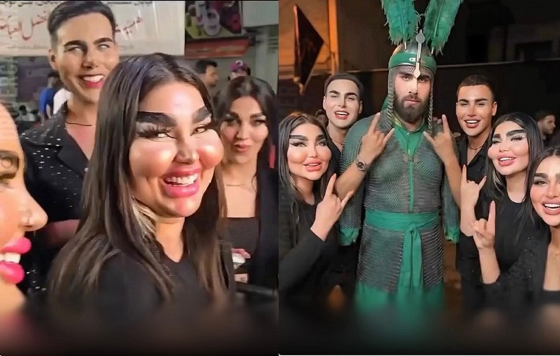 İran cinisiyyət dəyişdirənlərin sayına görə lider ölkələrdəndir