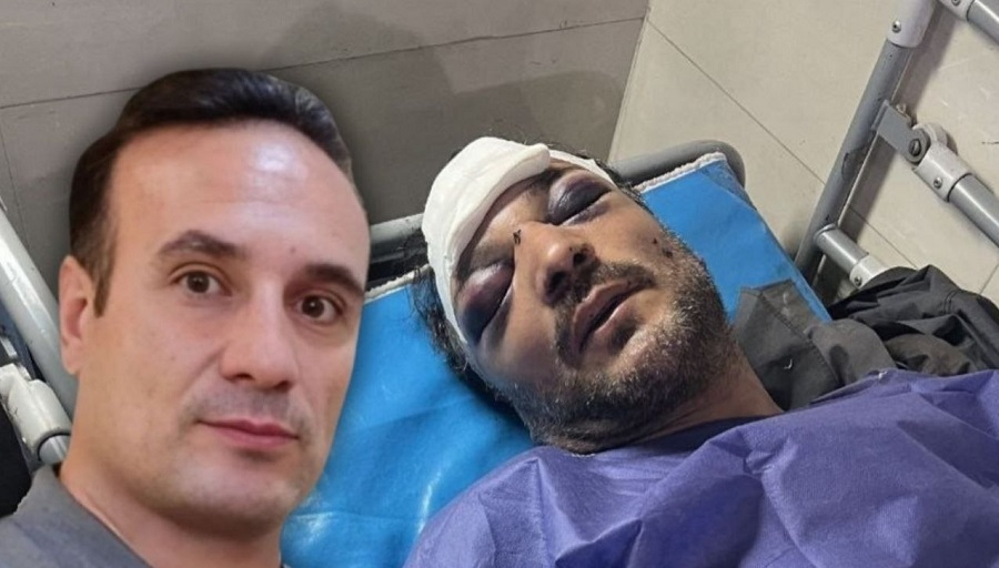 ضرب‌وشتم شدید «محمدرضا مرادبهروزی» زندانی سیاسی در زندان قزوین و جراحت صورت و شکستگی دنده‌هایش