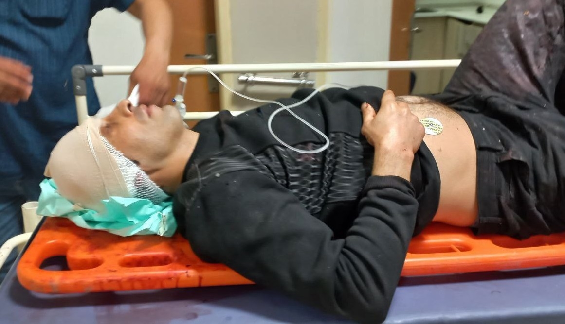 «شهرام داداشی» فعال آذربایجانی بر اثر تصادف در جاده آذرشهر-تبریز مجروح شد
